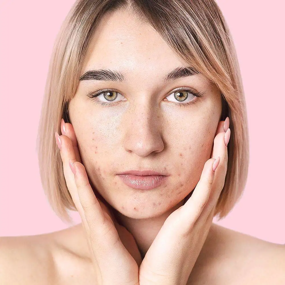 Skin Lightening Facial Oil- Lightening, Firming and Hydrating- 15ml - 100% Pure and Natural 5 SKIN LIGHTENING 08